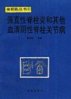 强直性脊柱炎和其他血清阴性脊柱关节病
