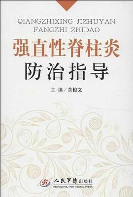 强直性脊柱炎防治指导