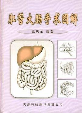 肛管大肠手术图解