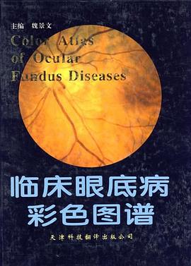 临床眼底病彩色图谱