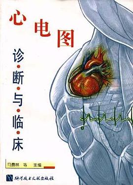 心电图诊断与临床